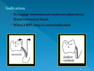 DIRECT RETAINERS.ppt