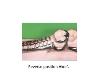 Direct retainers.pptx