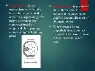 Reciprocal Tooth DIRECT RETAINERS in removablepartialdenture.pptx