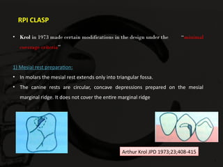 Direct Retainers in removable partial denture | PPTX