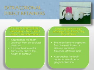 Occlusally approaching / 
Suprabulge / Ney Type I 
clasp / Circumferential: 
• Approaches the tooth 
undercut from an occlusal 
direction 
• It is attached to metal 
framework above the 
height of contour. 
Gingivally approaching / 
Infrabulge/ Bar/ Roach / Ney 
Type II Clasp: 
• The retentive arm originates 
from the metal base or 
denture framework 
traverses soft tissue and 
• Approaches the tooth 
undercut area from a 
gingival direction. 
EXTRACORONAL 
DIRECT RETAINERS 
 