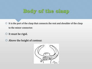 Body of the clasp 
 It is the part of the clasp that connects the rest and shoulder of the clasp 
to the minor connector. 
 It must be rigid. 
 Above the height of contour. 
 
