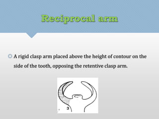 Reciprocal arm 
 A rigid clasp arm placed above the height of contour on the 
side of the tooth, opposing the retentive clasp arm. 
 