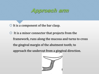 Approach arm 
 It is a component of the bar clasp. 
 It is a minor connector that projects from the 
framework, runs along the mucosa and turns to cross 
the gingival margin of the abutment tooth; to 
approach the undercut from a gingival direction. 
 