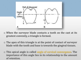 o When the surveyor blade contacts a tooth on the cast at its 
greatest convexity, a triangle is formed. 
o The apex of this triangle is at the point of contact of surveyor 
blade with the tooth and base is towards the gingival tissues. 
o This apical angle is called angle of cervical convergence. The 
importance of this angle lies in its relationship to the amount 
of retention. 
 