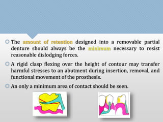  The amount of retention designed into a removable partial 
denture should always be the minimum necessary to resist 
reasonable dislodging forces. 
 A rigid clasp flexing over the height of contour may transfer 
harmful stresses to an abutment during insertion, removal, and 
functional movement of the prosthesis. 
 An only a minimum area of contact should be seen. 
 