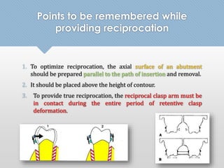 Points to be remembered while 
providing reciprocation 
1. To optimize reciprocation, the axial surface of an abutment 
should be prepared parallel to the path of insertion and removal. 
2. It should be placed above the height of contour. 
3. To provide true reciprocation, the reciprocal clasp arm must be 
in contact during the entire period of retentive clasp 
deformation. 
 