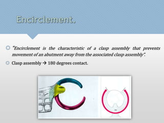 Encirclement. 
 “Encirclement is the characteristic of a clasp assembly that prevents 
movement of an abutment away from the associated clasp assembly”. 
 Clasp assembly  180 degrees contact. 
 