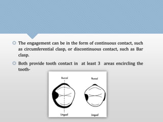  The engagement can be in the form of continuous contact, such 
as circumferential clasp, or discontinuous contact, such as Bar 
clasp. 
 Both provide tooth contact in at least 3 areas encircling the 
tooth- 
 