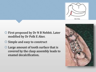  First proposed by Dr N B Nebbit. Later 
modified by Dr Polk E Aker. 
 Simple and easy to construct 
 Large amount of tooth surface that is 
covered by the clasp assembly leads to 
enamel decalcification. 
 
