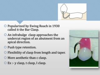  Popularized by Ewing Roach in 1930 
called it the Bar Clasp. 
 An infrabulge clasp approaches the 
undercut region of an abutment from an 
apical direction. 
 Push type retention. 
 Flexibility of clasp from length and taper. 
 More aesthetic than c clasp. 
 Ex :- y clasp, t clasp, I clasp. 
 