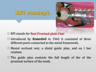 RPI concept. 
 RPI stands for Rest Proximal plate I bar. 
 Introduced by Kratochvil in 1963 it consisted of three 
different parts connected to the metal framework. 
 Mesial occlusal rest, a distal guide plan, and an I bar 
retainer. 
 The guide plan contacts the full length of the of the 
proximal surface of the tooth. 
 