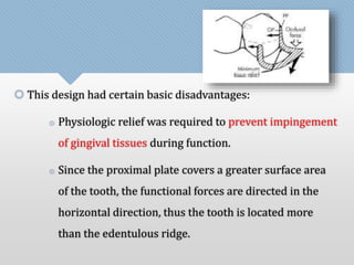  This design had certain basic disadvantages: 
 Physiologic relief was required to prevent impingement 
of gingival tissues during function. 
 Since the proximal plate covers a greater surface area 
of the tooth, the functional forces are directed in the 
horizontal direction, thus the tooth is located more 
than the edentulous ridge. 
 