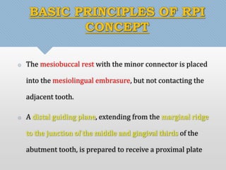 BASIC PRINCIPLES OF RPI 
CONCEPT 
 The mesiobuccal rest with the minor connector is placed 
into the mesiolingual embrasure, but not contacting the 
adjacent tooth. 
 A distal guiding plane, extending from the marginal ridge 
to the junction of the middle and gingival thirds of the 
abutment tooth, is prepared to receive a proximal plate 
 
