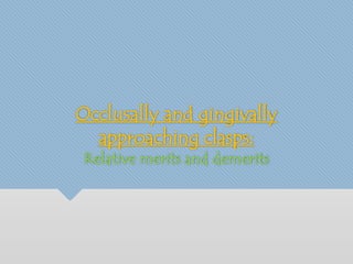 Occlusally and gingivally 
approaching clasps: 
Relative merits and demerits 
 