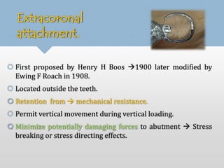 Extracoronal 
attachment. 
 First proposed by Henry H Boos 1900 later modified by 
Ewing F Roach in 1908. 
 Located outside the teeth. 
 Retention from  mechanical resistance. 
 Permit vertical movement during vertical loading. 
 Minimize potentially damaging forces to abutment  Stress 
breaking or stress directing effects. 
 