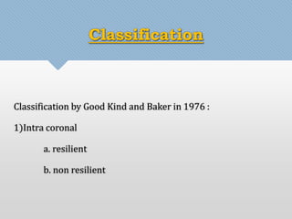 Classification 
Classification by Good Kind and Baker in 1976 : 
1)Intra coronal 
a. resilient 
b. non resilient 
 