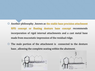  Another philosophy , known as the stable base precision attachment 
RPD concept or floating denture base concept recommends 
incorporation of rigid internal attachments and a cast metal base 
made from mucostatic impression of the residual ridge. 
 The male portion of the attachment is connected to the denture 
base , allowing the complete seating within the abutment. 
 