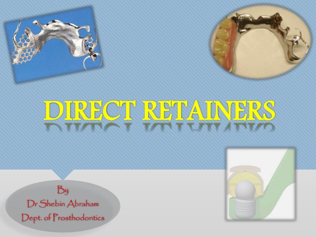 Direct retainers in removable partial dentures