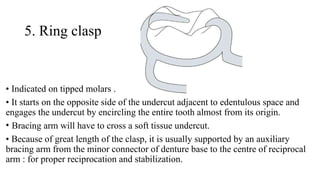 DIRECT RETAINERS IN REMOVABLE PARTIAL DENTURE | PPTX