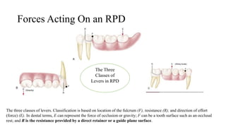 Direct retainers i | PPTX