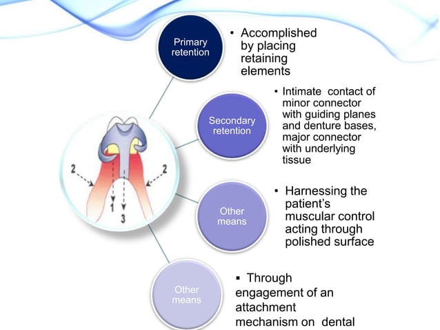 Direct retainers part i | PPTX | Oral care | Personal Care