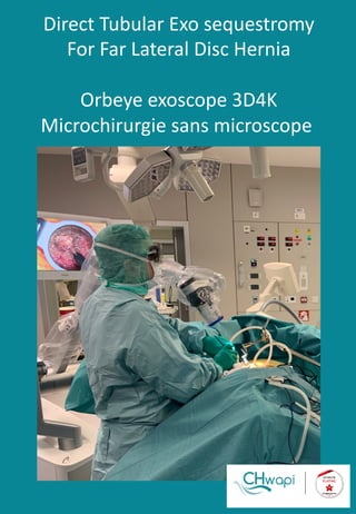 Direct Tubular Exo sequestromy
For Far Lateral Disc Hernia
Orbeye exoscope 3D4K
Microchirurgie sans microscope
 