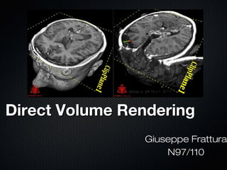 Direct Volume Rendering
                Giuseppe Frattura
                    N97/110
 