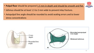 30
 Initial cavity preparation should be done with the flat end tapered
carbide bur
 This result in facial and lingual walls that diverge occlusally
• Pulpal floor should be prepared 1.5 mm in depth and should be smooth and flat.
• Isthmus should be at least 1.5 to 2 mm wide to prevent inlay fracture.
• Axiopulpal line angle should be rounded to avoid seating errors and to lower
stress concentrations
 