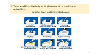 6
 There are different techniques for placement of composite resin
restorations.
Includes direct and indirect technique.
 