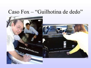 Caso Fox – “Guilhotina de dedo” 