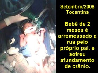 Setembro/2008 Tocantins Bebê de 2 meses é arremessado a rua pelo próprio pai, e sofreu afundamento de crânio. 