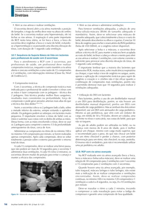 Arq Bras Cardiol: 2013; 101, (2 Supl. 3): 1-221
Diretrizes
I Diretriz de Ressuscitação Cardiopulmonar e
Cuidados Cardiovasculares de Emergência da
Sociedade Brasileira de Cardiologia
•	Abrir as vias aéreas e realizar ventilações
O socorrista deverá abrir a via aérea mantendo a posição
de farejador, o trago da orelha deve estar na altura do ombro
do bebê. Se o socorrista realizar uma hiperextensão, ele irá
fechar as vias aéreas. A respiração é uma parte importante
da RCP, nesta faixa etária, se for boca a boca, a boca do
socorrista deve englobar a boca e o nariz do bebê, evitando-
se a hiperventilação e ocasionando uma discreta elevação do
tórax, com duração de 1 segundo cada ventilação.
10.7. Sequência de Suporte Básico de Vida em lactentes
para profissionais de saúde com 2 socorristas
Para o atendimento a RCP com 2 socorristas, por
profissionais de saúde, um profissional deve realizar
compressões torácicas, enquanto o outro mantém a via aérea
aberta e executa ventilações a uma razão de 15 compressões
e 2 ventilações, com interrupções mínimas (Classe IIa, Nível
de Evidência C).
•	Compressões torácicas
Com 2 socorristas, a técnica de compressão torácica mais
indicada para o profissional de saúde é envolver o tórax com
as mãos e fazer compressão com os polegares - técnica dos
2 polegares. Esta técnica produz melhor fluxo sanguíneo,
resultados mais consistentes na profundidade, força de
compressão e pode gerar pressões arteriais mais altas do que
a técnica dos dois dedos1250-1254
.
Assim, o socorrista coloca os 2 polegares lado a lado, sobre
a metade inferior do esterno, sempre evitando o apêndice
xifoide. Os polegares podem se sobrepor, em lactentes muito
pequenos. É importante envolver o tórax do bebê com as
mãos e sustentar suas costas com os dedos de ambas as mãos.
Dessa forma, com as mãos envolvendo o tórax, deve-se usar
os 2 polegares para comprimir o esterno 1/3 da profundidade
anteroposterior do tórax, cerca de 4cm.
Administrar as compressões no ritmo de no mínimo 100 e
no máximo 120 compressões por minuto, se forem realizadas
apenas compressões. Após cada compressão, deve-se soltar
totalmente a pressão sobre o esterno para permitir o retorno
total do tórax.
A cada 15 compressões, deve-se realizar uma breve pausa,
que não poderá ser mais de 10 segundos para o socorrista 1
administrar duas ventilações. A cada 10 ciclos (2 minutos), os
socorristas devem mudar de posição para evitar o cansaço e
manter a eficácia das compressões.
•	Abrir as vias aéreas e administrar ventilações
Para fornecer ventilações adequadas, a seleção de uma
bolsa-válvula-máscara (BVM) de tamanho adequado é
mandatória. Assim, deve-se selecionar uma máscara de
tamanho adequado, que cubra totalmente a boca e o nariz do
bebê, deixando descobertos os olhos e o queixo. Conectar 10
litros de oxigênio para encher o reservatório da BVM pediátrica
(bolsa de 450-500ml), se o oxigênio estiver disponível.
Após selecionar a bolsa e a máscara, o socorrista deve
utilizar a técnica do EC para manter a máscara bem acoplada
ao rosto do bebê, inclinar a cabeça e elevar o mento para abrir
as vias aéreas e realizar 2 ventilações, com volume corrente o
suficiente para provocar uma discreta elevação do tórax, de
1 segundo cada ventilação.
É importante lembrar que a maioria dos lactentes que
desenvolve PCR, muitas vezes, sofre insuficiência respiratória
ou choque, o que reduz o teor de oxigênio no sangue, assim,
apenas a aplicação de compressões torácicas para suprir de
oxigênio o coração e o cérebro não é tão eficaz quanto a
combinação de compressões mais ventilações, porém não
é permitido demorar mais que 10 segundos para realizar 2
ventilações adequadas.
•	Utilização do DEA em lactentes
Para lactentes, prefira o uso de um desfibrilador manual
a um DEA para desfibrilação, porém, se não houver um
desfibrilador manual disponível, prefira um DEA com
atenuador de carga pediátrico. Mas se nenhum dos dois estiver
disponível, use um DEA sem atenuador de carga pediátrico.
Mesmo as pás pediátricas, que vêm com um redutor de
carga, em média de 50 a 70 Joules, devem ser coladas, uma
na frente no tórax e outra atrás, nas costas do bebê, para que
não se toquem.
As pás de adulto podem ser utilizadas no bebê, ou na
criança com menos de 8 anos de idade, pois é melhor
aplicar um choque, mesmo com carga muito superior, que
o recomendado para o peso, do que não chocar um bebê
em um ritmo chocável e perder a chance, com posterior
deterioração para um ritmo, não chocável, ou seja, assistolia.
O inverso não é verdadeiro, pois não é recomendado utilizar
uma pá pediátrica no adulto.
10.8. RCP com via aérea avançada
Na RCP realizada sem via aérea avançada (boca a boca,
boca a máscara e bolsa-valva-máscara), deve-se realizar uma
relação de 30 compressões para 2 ventilações com 1 socorrista
e 15 compressões para 2 ventilações com 2 socorristas.
Quando houver uma via aérea avançada, por exemplo,
tubo traqueal, máscara laríngea e tubo laríngeo, não existe
mais a indicação de se realizar compressões e ventilações
sincronizadas. Assim, deve-se realizar compressões
contínuas, no mínimo 100 e no máximo 120 compressões e 1
ventilação a cada 6 a 8 segundos, ou seja, 8 a 10 ventilações
por minuto
Deve-se reavaliar o ritmo a cada 2 minutos, trocando
o compressor a cada reavaliação para evitar a fadiga do
compressor e garantir uma compressão de boa qualidade.Figura 54 - Técnica de compressão torácica com 2 socorristas.
94
 