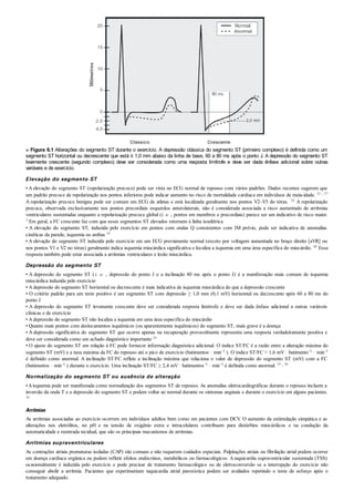 ■ Figura 6.1 Alterações do segmento ST durante o exercício. A depressão clássica do segmento ST (primeiro complexo) é definida como um
segmento ST horizontal ou decrescente que está ≥ 1,0 mm abaixo da linha de base, 60 a 80 ms após o ponto J. A depressão do segmento ST
levemente crescente (segundo complexo) deve ser considerada como uma resposta limítrofe e deve ser dada ênfase adicional sobre outras
variáveis e de exercício.
Elevação do segmento ST
• A elevação do segmento ST (repolarização precoce) pode ser vista no ECG normal de repouso com vários padrões. Dados recentes sugerem que
um padrão precoce de repolarização nos pontos inferiores pode indicar aumento no risco de mortalidade cardíaca em indivíduos de meia-idade. 53 , 57
A repolarização precoce benigna pode ser comum em ECG de atletas e está localizada geralmente nos pontos V2–V5 do tórax. 24 A repolarização
precoce, observada exclusivamente nos pontos precordiais esquerdos anterolaterais, não é considerada associada a risco aumentado de arritmias
ventriculares sustentadas enquanto a repolarização precoce global (i. e. , pontos em membros e precordiais) parece ser um indicativo de risco maior.
3 Em geral, a FC crescente faz com que esses segmentos ST elevados retornem à linha isoelétrica
• A elevação do segmento ST, induzida pelo exercício em pontos com ondas Q consistentes com IM prévio, pode ser indicativa de anomalias
cinéticas da parede, isquemia ou ambas 10
• A elevação do segmento ST induzida pelo exercício em um ECG previamente normal (exceto por voltagem aumentada no braço direito [aVR] ou
nos pontos V1 e V2 no tórax) geralmente indica isquemia miocárdica significativa e localiza a isquemia em uma área específica do miocárdio. 48 Essa
resposta também pode estar associada a arritmias ventriculares e lesão miocárdica.
Depressão do segmento ST
• A depressão do segmento ST (i. e. , depressão do ponto J e a inclinação 80 ms após o ponto J) é a manifestação mais comum de isquemia
miocárdica induzida pelo exercício
• A depressão do segmento ST horizontal ou decrescente é mais indicativa de isquemia miocárdica do que a depressão crescente
• O critério padrão para um teste positivo é um segmento ST com depressão ≥ 1,0 mm (0,1 mV) horizontal ou decrescente após 60 a 80 ms do
ponto J
• A depressão do segmento ST levemente crescente deve ser considerada resposta limítrofe e deve ser dada ênfase adicional a outras variáveis
clínicas e de exercício
• A depressão do segmento ST não localiza a isquemia em uma área específica do miocárdio
• Quanto mais pontos com deslocamentos isquêmicos (ou aparentemente isquêmicos) do segmento ST, mais grave é a doença
• A depressão significativa do segmento ST que ocorre apenas na recuperação provavelmente representa uma resposta verdadeiramente positiva e
deve ser considerada como um achado diagnóstico importante 34
• O ajuste do segmento ST em relação à FC pode fornecer informação diagnóstica adicional. O índice ST/FC é a razão entre a alteração máxima do
segmento ST (mV) e a taxa máxima da FC do repouso até o pico de exercício (batimentos · min–1 ). O índice ST/FC > 1,6 mV · batimento–1 · min–1
é definido como anormal. A inclinação ST/FC reflete a inclinação máxima que relaciona o valor de depressão do segmento ST (mV) com a FC
(batimentos · min–1 ) durante o exercício. Uma inclinação ST/FC ≥ 2,4 mV · batimentos–1 · min–1 é definida como anormal. 29 , 30
Normalização do segmento ST ou ausência de alteração
•Aisquemia pode ser manifestada como normalização dos segmentos ST de repouso. As anomalias eletrocardiográficas durante o repouso incluem a
inversão da onda T e a depressão do segmento ST e podem voltar ao normal durante os sintomas anginais e durante o exercício em alguns pacientes.
36
Arritmias
As arritmias associadas ao exercício ocorrem em indivíduos adultos bem como em pacientes com DCV. O aumento da estimulação simpática e as
alterações nos eletrólitos, no pH e na tensão de oxigênio extra e intracelulares contribuem para distúrbios miocárdicos e na condução da
automaticidade e reentrada tecidual, que são os principais mecanismos de arritmias.
Arritmias supraventriculares
As contrações atriais prematuras isoladas (CAP) são comuns e não requerem cuidados especiais. Palpitações atriais ou fibrilação atrial podem ocorrer
em doença cardíaca orgânica ou podem refletir efeitos endócrinos, metabólicos ou farmacológicos. Ataquicardia supraventricular sustentada (TSS)
ocasionalmente é induzida pelo exercício e pode precisar de tratamento farmacológico ou de eletroconversão se a interrupção do exercício não
conseguir abolir a arritmia. Pacientes que experimentam taquicardia atrial paroxística podem ser avaliados repetindo o teste de esforço após o
tratamento adequado.
 