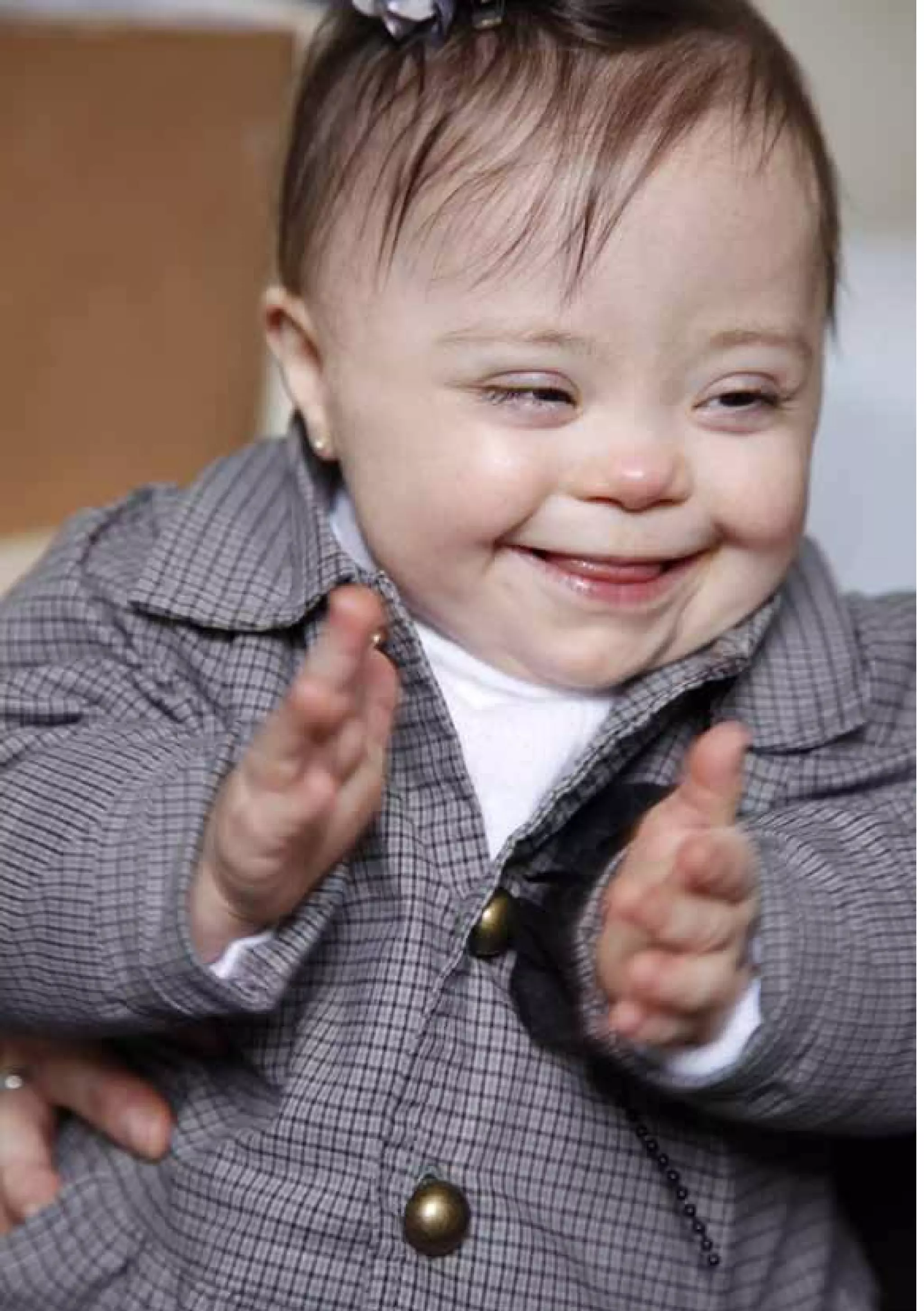 Diretrizes de Atenção
à Pessoa com Síndrome de Down 45
 