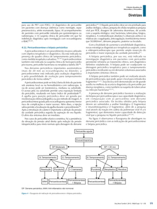 Arq Bras Cardiol: 2013; 100(4 Supl. 1): 1-36
Diretrizes
I Diretriz Brasileira de
Miocardites e Pericardites
para uso de PET com FDG); (3) diagnóstico de pericardite
em pacientes com doenças sistêmicas como meningite, sepse
pneumocócica, artrite reumatoide, lúpus; (4) acompanhamento
de pacientes com pericardite induzida por quimioterápicos ou
radioterapia; e (5) suspeita clínica de pericardite em que há
indefinição diagnóstica após investigação com ecocardiograma
e RMC204,205
.
4.11. Pericardiocentese e biópsia pericárdica
A pericardiocentese é um procedimento invasivo utilizado
com objetivo terapêutico e diagnóstico. Ela está indicada na
presença de quadro clínico de tamponamento pericárdico,
como medida terapêutica salvadora.168,195
A pericardiocentese
também está indicada na suspeita clínica de hemopericárdio
pós trauma, pericardite bacteriana ou neoplásica (tabela 28)206
.
Nos derrames pericárdicos importantes assintomáticos
(mais de 20 mm ao ecocardiograma na diástole), a
pericardiocentese está indicada para avaliação diagnóstica
e pela possibilidade de evolução para tamponamento
pericárdico de forma súbita207
.
A pericardiocentese pode ser feita à beira do leito do paciente
sob anestesia local ou na hemodinâmica com radioscopia. A
via de acesso pode ser transtorácica, mediana ou subxifoide.
O acesso pela via subxifoide permite uma exposição limitada
do pericárdio, resultando em baixo índice de positividade208
.
A agulha para punção pericárdica deve ser guiada por
monitorização eletrocardiográfica ou por método de imagem. A
pericardiocentese guiada pelo ecocardiograma apresenta menor
risco de complicações e maior sucesso. Além disso, a injeção
salinapermitealocalizaçãodaagulhaduranteoprocedimento209
.
Após a introdução do cateter é importante a aferição da pressão
da cavidade pericárdica seguida da aspiração do seu líquido.
O alívio dos sintomas deve ser imediato.
Nos casos de pericardite-efusivo-constritiva, há a persistência
da elevação da pressão atrial direita após redução da pressão
intrapericárdica para níveis normais após drenagem do derrame
pericárdico210
. O líquido pericárdico deve ser encaminhado para
análisecitológica,cultura,pesquisadecélulasneoplásicaspesquisa
viral por PCR, dosagem de adenosina deaminase, de acordo
com a suspeita etiológica: viral, bacteriana, tuberculosa, fúngica,
neoplásica. A contraindicação absoluta é a dissecção aórtica e as
relativassão:coagulopatia,anticoagulação,trombocitemiamenor
que 50.000/mm3
, derrame pequeno, posterior ou loculado.
Com a finalidade de aumentar a sensibilidade diagnóstica,
novas estratégicas diagnósticas e terapêuticas surgiram, como
a vídeopericardioscopia que permite ampla ressecção do
pericárdio e maior exposição da cavidade pericárdica211
.
A biópsia pericárdica, por sua vez, está indicada na
investigação diagnóstica em pacientes com pericardite
persistente refratária ao tratamento clínico, sem diagnóstico
definitivo estabelecido. A biópsia pode ser coadjuvante na
drenagem pericárdica terapêutica para o tamponamento
pericárdico recidivante ou em derrames volumosos associados
à importantes sintomas clínicos.
A biópsia pericárdica também pode ser realizada através
de pericardioscopia, que pode, guiar o local para retirada dos
fragmentos212,213
. Essa técnica tem demonstrado ser de grande
auxílio na melhora da acurácia diagnóstica da pericardite por
doença neoplásica, como também na suspeita de tuberculose
ou infecção bacteriana214,215
.
A presença de derrame pericárdico favorece a realização
da biópsia por pericardioscopia e sua capacidade diagnóstica,
em comparação com as pericardites sem derrame
pericárdico associado. Os tecidos obtidos pela biópsia
devem ser submetidos a análise histológica (2 fragmentos)
e imunohistoquímica (2 fragmentos), além de a pesquisa
viral através da reação em cadeia da polimerase viral (4 a 6
fragmentos), que demonstra maior capacidade de detecção
viral que a pesquisa no líquido pericárdico216-218
.
Na figura 4 observamos o fluxograma de abordagem no
derrame pericárdico com as indicações de pericardiocentese
e biópsia pericárdica.
Figura 4 - Fluxograma de indicação de pericardiocentese e biópsia pericárdica.
DP: Derrame pericárdico; AINH; Anti-inflamatório não hormonal.
Pericardite aguda
Ecocardiograma
DP Moderado DP > 20 mm
S/ Tamponamento C/ Tamponamento
Purulento Neoplastico Recidiva
Pericardiocentese
Pericardiocentese
+ Biópsia
Pericardiocentese
+ Biópsia
PericardiocenteseAINH
C/ TamponamentoS/ Tamponamento
Resolução Purulento > 3 semanas
19
 