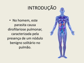 • No homem, este
parasita causa
dirofilariose pulmonar,
caracterizada pela
presença de um nódulo
benigno solitário no
pulmão.
INTRODUÇÃO
 