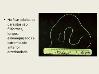 • Na fase adulta, os
parasitas são
filiformes,
longos,
esbranquiçados e
extremidade
anterior
arredondada
 