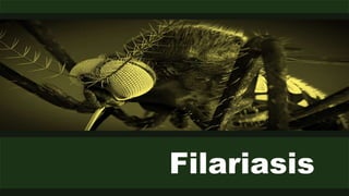 Filariasis
 