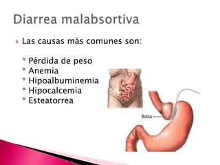    Las causas màs comunes son:

    *   Pérdida de peso
    *   Anemia
    *   Hipoalbuminemia
    *   Hipocalcemia
    *   Esteatorrea
 