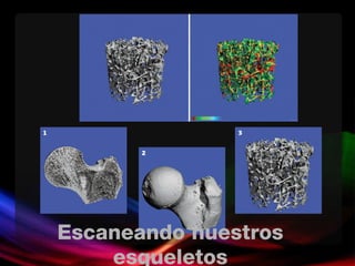 Escaneando nuestros esqueletos 