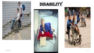 disability
4/13/2022 11
Dr. C. BEULAH JAYARANIi
 