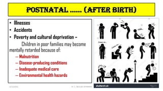 postnatal …… (after birth)
• Illnesses
• Accidents
• Poverty and cultural deprivation –
Children in poor families may become
mentally retarded because of:
– Malnutrition
– Disease-producing conditions
– Inadequate medical care
– Environmental health hazards
4/13/2022 27
Dr. C. BEULAH JAYARANIi
 