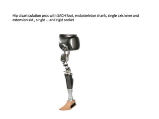 Hip disarticulation pros with SACH foot, endoskeleton shank, single axis knee and
extension aid , single … and rigid socket
 