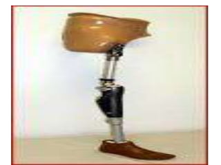 Disarticulated arthosis