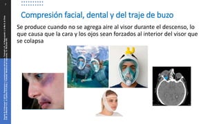 7
Se produce cuando no se agrega aire al visor durante el descenso, lo
que causa que la cara y los ojos sean forzados al interior del visor que
se colapsa
Compresión facial, dental y del traje de buzo
Snyder
B,
&
Neuman
T
(2013).
Disbarismo
y
complicaciones
del
buceo.
Tintinalli
J.E.,
&
Stapczynski
J,
&
Ma
O,
&
Cline
D.M.,
&
Meckler
G.D.,
&
Cydulka
R.K.(Eds.),
Tintinalli.
Medicina
de
urgencias,
7e.
McGraw
Hill.
 