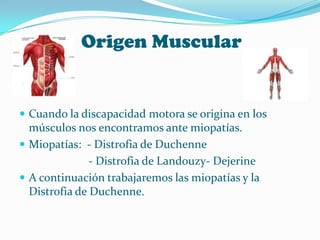 Origen Muscular


 Cuando la discapacidad motora se origina en los
  músculos nos encontramos ante miopatías.
 Miopatías: - Distrofia de Duchenne
               - Distrofia de Landouzy- Dejerine
 A continuación trabajaremos las miopatías y la
  Distrofia de Duchenne.
 