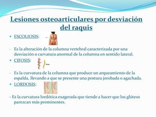 Lesiones osteoarticulares por desviación
               del raquis
 ESCOLIOSIS:


- Es la alteración de la columna vertebral caracterizada por una
  desviación o curvatura anormal de la columna en sentido lateral.
 CIFOSIS:


- Es la curvatura de la columna que produce un arqueamiento de la
  espalda, llevando a que se presente una postura jorobada o agachada.
 LORDOSIS:


- Es la curvatura lordótica exagerada que tiende a hacer que los glúteos
   parezcan más prominentes.
 