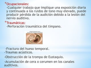 *Ocupacionales:
-Cualquier trabajo que implique una exposición diaria
y continuada a los ruidos de tono muy elevado, puede
producir pérdida de la audición debido a la lesión del
nervio auditivo.
*Traumáticas:
-Perforación traumática del tímpano.
-Fractura del hueso temporal.
-Traumas acústicos.
-Obstrucción de la trompa de Eustaquio.
-Acumulación de cera o cerumen en los canales
auditivos.
 