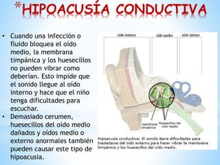 *HIPOACUSÍA CONDUCTIVA
• Cuando una infección o
fluido bloquea el oído
medio, la membrana
timpánica y los huesecillos
no pueden vibrar como
deberían. Esto impide que
el sonido llegue al oído
interno y hace que el niño
tenga dificultades para
escuchar.
• Demasiado cerumen,
huesecillos del oído medio
dañados y oídos medio o
externo anormales también
pueden causar este tipo de
hipoacusia.
 